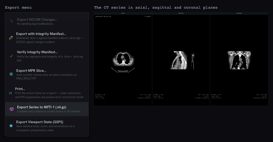 The dcmage Export menu with Export Series to NIfTI-1 highlighted, next to a CT series in axial, sagittal and coronal planes