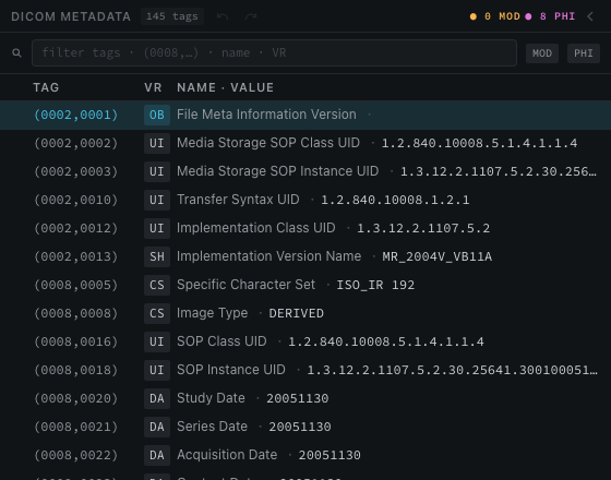 dcmage tag tree showing real DICOM metadata