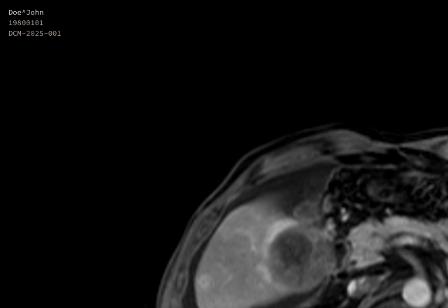 dcmage MR viewer showing abdominal MRI with W/L controls